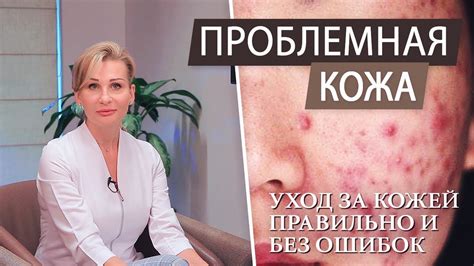 Диета и уход за кожей для предотвращения прыщей