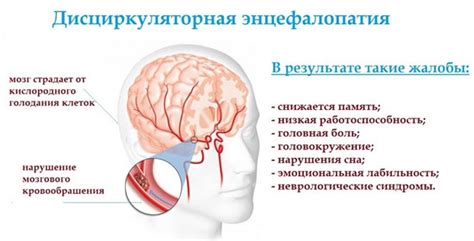 Дисциркуляторная энцефалопатия: что это такое?