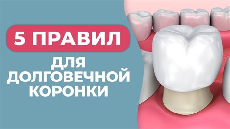 Длительность службы коронки