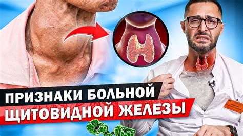 Долгосрочные последствия низко расположенной щитовидной железы