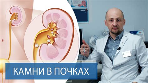 Дополнительные методы диагностики новообразований в почках