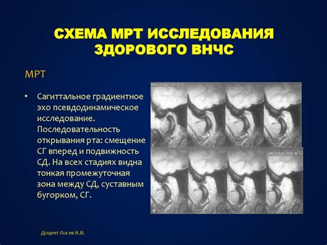 Дополнительные методы диагностики при невидимости мочеточников