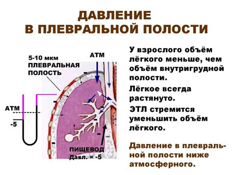 Дренирование плевральной полости