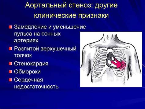 Другие факторы, способствующие пропадению пульса