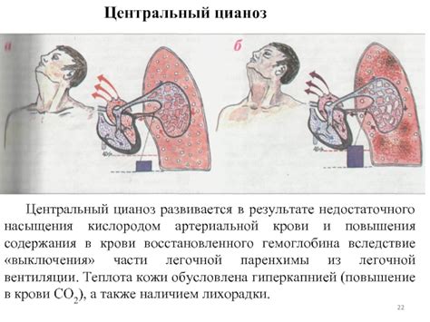 Дыхательная гимнастика для повышения насыщения крови кислородом