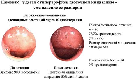 Дыхательные проблемы и аллергии