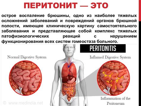 Заболевания, приводящие к пониженной глюкозе