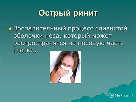 Заболевания верхних дыхательных путей: фарингит, ларингит