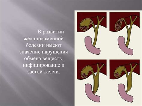 Заболевания гепатобилиарной системы