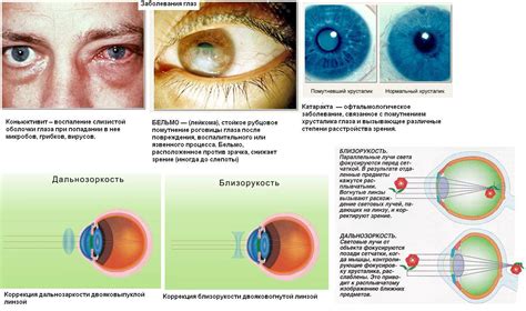 Заболевания глаз и обратимость эффекта