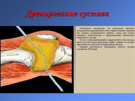 Заболевания костей и суставов, вызывающие вмятину на ягодице