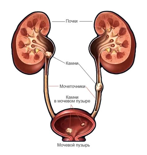 Заболевания мочевого пузыря и почек