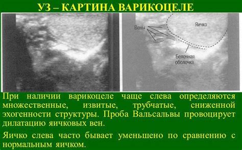 Заболевания связанные со синусами Вальсальвы