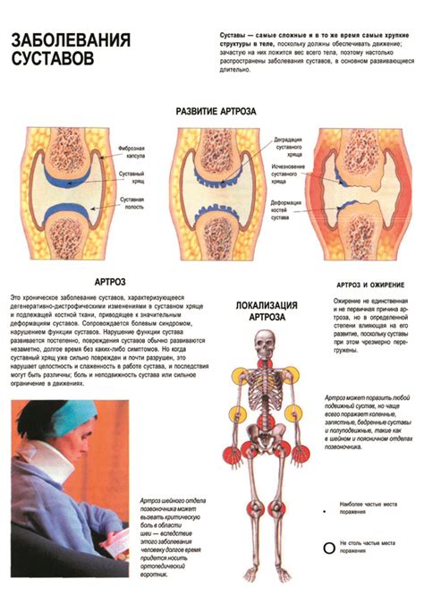 Заболевания суставов