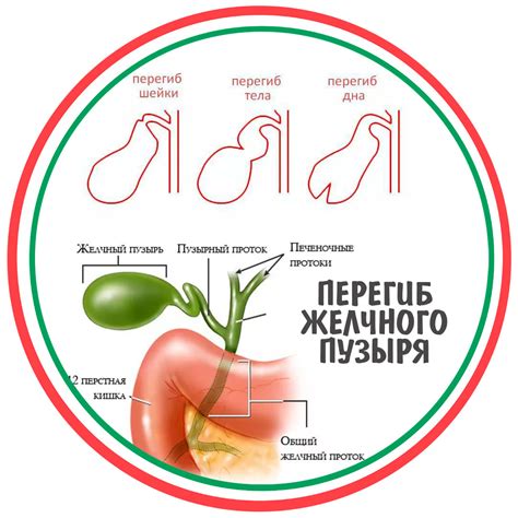 Загиб крюка левый: что это означает и как выполнить