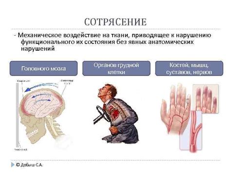 Зазоры и механическое воздействие: почему необходимо контролировать