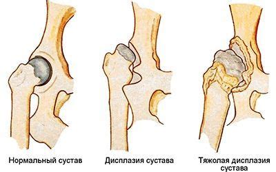 Замыкание сустава у взрослых: симптомы и лечение