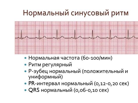 Зарегистрированный синусовый ритм: основные понятия