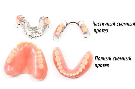 Зачем нужно натирать съемный нижний зубной протез?