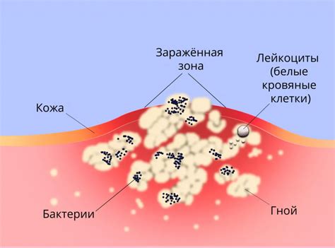 Зияющая рана: причины, симптомы и лечение