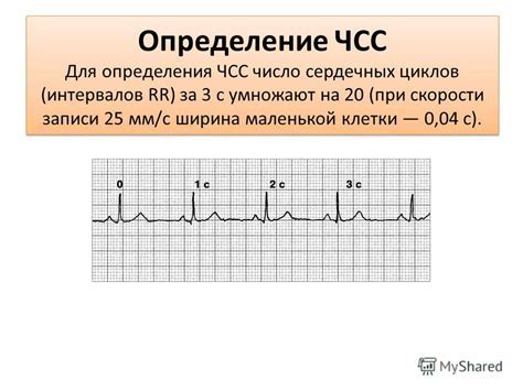 Значение ЧСС для профилактики заболеваний