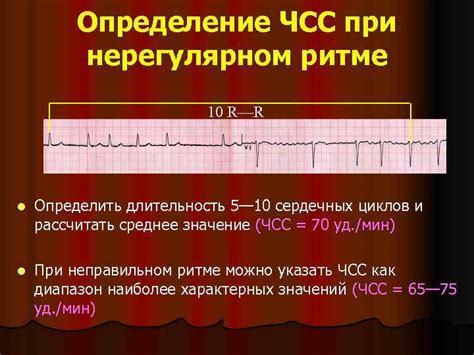 Значение ЧСС при УЗИ