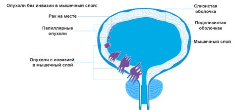 Значение анэхогенности мочевого пузыря