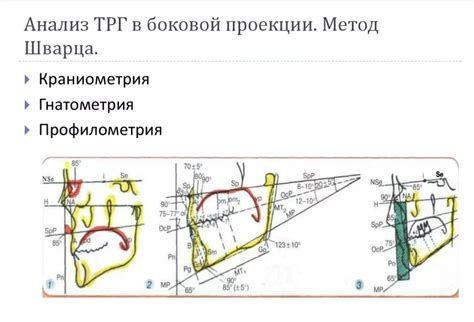 Значение боковой проекции в проектировании