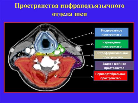 Значение головы Нимрода