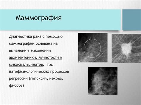 Значение голоядерных клеток в диагностике рака молочной железы