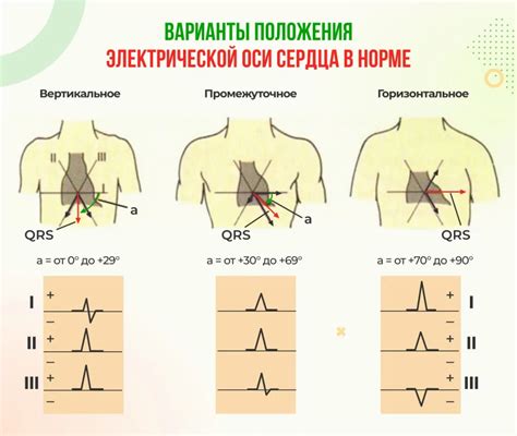 Значение горизонтального направления электрической оси сердца