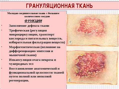 Значение грануляции раны