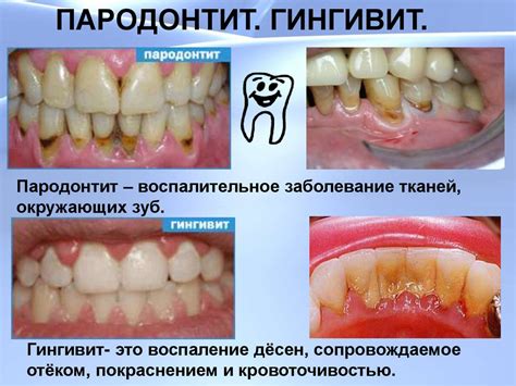 Значение заговоренных зубов