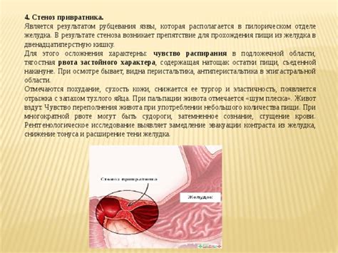 Значение зияния привратника гастродуоденального сосочка для организма