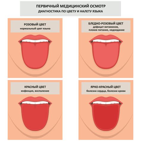 Значение и особенности корня языка коричневого цвета у взрослых