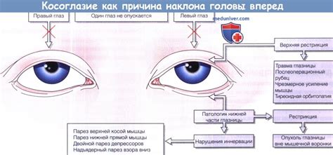 Значение и причины наклона