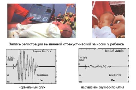 Значение отоакустической эмиссии в диагностике патологий у новорожденных