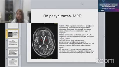 Значение отсутствия невротического паттерна ЭЭГ