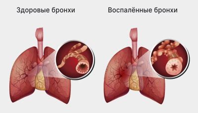 Значение отхаркивания