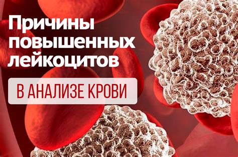 Значение повышенных лейкоцитов