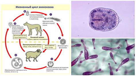 Значение положительного результата Эхинококк IgG: что это означает?