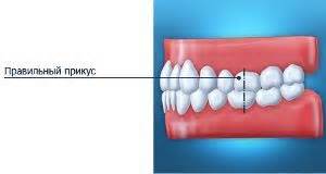 Значение правильного прикуса