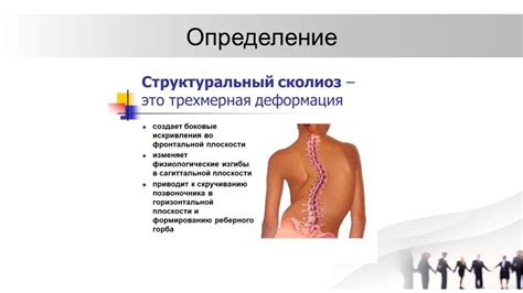 Значение правильной осанки для человека