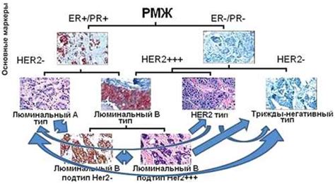 Значение HER2-отрицательного статуса при раке молочной железы