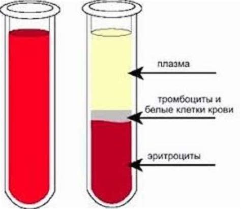 Значимость переливания плазмы