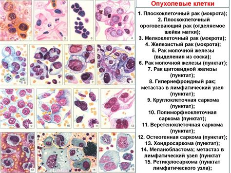 Значимость цитологического анализа экзоцервицита в диагностике заболеваний