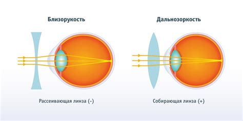 Зрение: как изменяется при наличии гипертензии