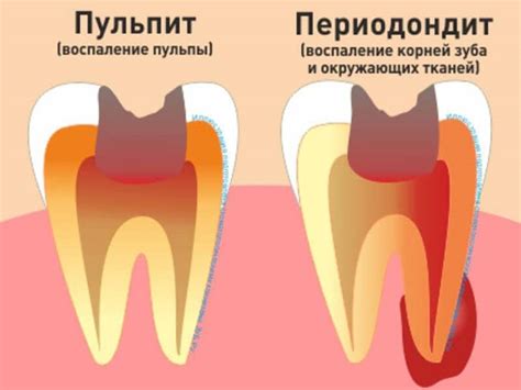 Зубные проблемы, где "С" является фактором