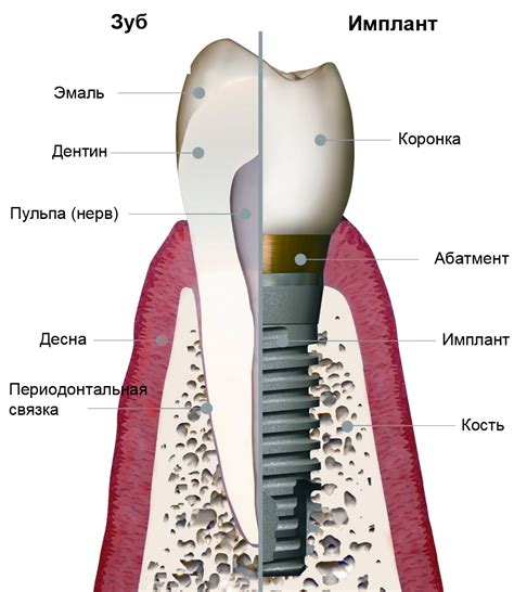 Зуб имплантант: суть и значимость