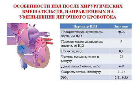 ИВЛ: значение ИВЛ в медицине